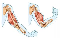 Myasthenia gravis