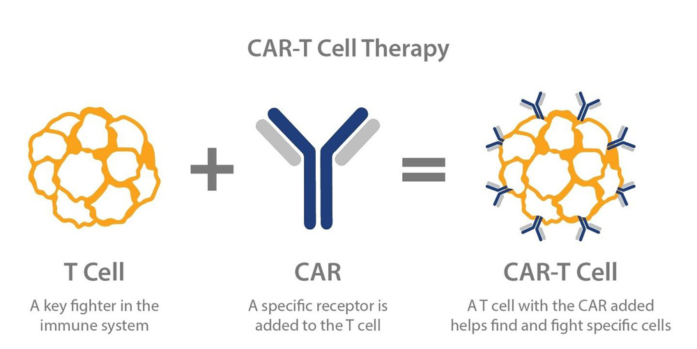 CAR-T therapy